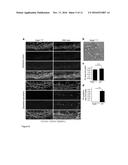 THERAPEUTIC USE OF VEGFR-3 LIGANDS diagram and image