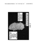 BONE REGENERATION USING BIODEGRADABLE POLYMERIC NANOCOMPOSITE MATERIALS     AND APPLICATIONS OF THE SAME diagram and image