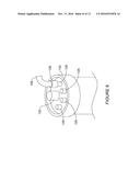 FLUID COLLECTION AND DISPOSAL SYSTEM diagram and image