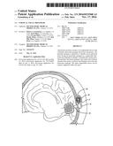 Cortical Visual Prosthesis diagram and image