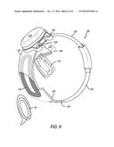 VISUAL PROSTHESIS INCLUDING AN IMPROVED VIDEO PROCESSING UNIT diagram and image