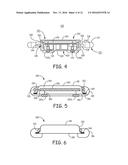 MINIMALLY INVASIVE IMPLANTABLE NEUROSTIMULATION SYSTEM diagram and image