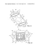 MINIMALLY INVASIVE IMPLANTABLE NEUROSTIMULATION SYSTEM diagram and image