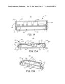 MINIMALLY INVASIVE IMPLANTABLE NEUROSTIMULATION SYSTEM diagram and image