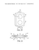 MINIMALLY INVASIVE IMPLANTABLE NEUROSTIMULATION SYSTEM diagram and image