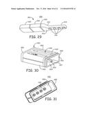 MINIMALLY INVASIVE IMPLANTABLE NEUROSTIMULATION SYSTEM diagram and image