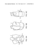 RENAL INJURY INHIBITING DEVICES, SYSTEMS, AND METHODS EMPLOYING     LOW-FREQUENCY ULTRASOUND OR OTHER CYCLICAL PRESSURE ENERGIES diagram and image