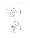 RENAL INJURY INHIBITING DEVICES, SYSTEMS, AND METHODS EMPLOYING     LOW-FREQUENCY ULTRASOUND OR OTHER CYCLICAL PRESSURE ENERGIES diagram and image