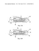 METHOD AND APPARATUS FOR THE TREATMENT OF TISSUE diagram and image