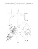 More Versatile Self-Bonding Cords diagram and image