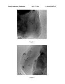 A PROCESS FOR VAPOR-PHASE METHANOL CARBONYLATION TO METHYL FORMATE, A     CATALYST USED IN THE PROCESS AND A METHOD FOR PREPARING THE CATALYST diagram and image