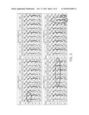 GENERALIZED SPHERICAL DECONVOLUTION IN DIFFUSION MAGNETIC RESONANCE     IMAGING diagram and image