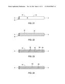 Catheter shaft with electrically-conductive traces diagram and image