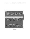 PHYSIOLOGICAL MAPPING FOR ARRHYTHMIA diagram and image