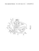 MULTI-POLE SYNCHRONOUS PULMONARY ARTERY RADIOFREQUENCY ABLATION CATHETER diagram and image