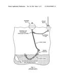 SUBMERSIBLE BUOY, INFLATION CONTROL SYSTEM AND KIT diagram and image