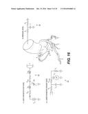 METHOD AND SYSTEM FOR IMAGE PROCESSING AND PATIENT-SPECIFIC MODELING OF     BLOOD FLOW diagram and image