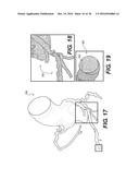 METHOD AND SYSTEM FOR IMAGE PROCESSING AND PATIENT-SPECIFIC MODELING OF     BLOOD FLOW diagram and image