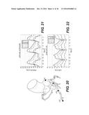 METHOD AND SYSTEM FOR IMAGE PROCESSING AND PATIENT-SPECIFIC MODELING OF     BLOOD FLOW diagram and image