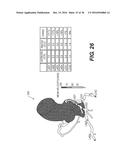 METHOD AND SYSTEM FOR IMAGE PROCESSING AND PATIENT-SPECIFIC MODELING OF     BLOOD FLOW diagram and image