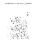 METHOD AND SYSTEM FOR IMAGE PROCESSING AND PATIENT-SPECIFIC MODELING OF     BLOOD FLOW diagram and image