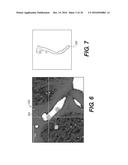 METHOD AND SYSTEM FOR IMAGE PROCESSING TO DETERMINE  PATIENT-SPECIFIC     BLOOD FLOW CHARACTERISTICS diagram and image