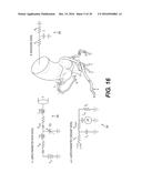 METHOD AND SYSTEM FOR IMAGE PROCESSING TO DETERMINE  PATIENT-SPECIFIC     BLOOD FLOW CHARACTERISTICS diagram and image