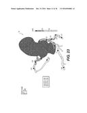 METHOD AND SYSTEM FOR IMAGE PROCESSING TO DETERMINE  PATIENT-SPECIFIC     BLOOD FLOW CHARACTERISTICS diagram and image