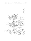 METHOD AND SYSTEM FOR IMAGE PROCESSING TO DETERMINE  PATIENT-SPECIFIC     BLOOD FLOW CHARACTERISTICS diagram and image