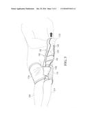 LEG MOBILITY ASSISTIVE GARMENT diagram and image