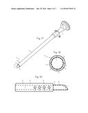 Atraumatic Arthroscopic Instrument Sheath diagram and image