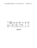 METHOD FOR ANALYSIS OF COMPLEX RHYTHM DISORDERS diagram and image