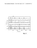 METHOD FOR ANALYSIS OF COMPLEX RHYTHM DISORDERS diagram and image