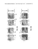 METHOD FOR ANALYSIS OF COMPLEX RHYTHM DISORDERS diagram and image