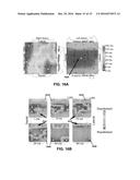 METHOD FOR ANALYSIS OF COMPLEX RHYTHM DISORDERS diagram and image