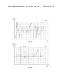 CONTEXTUAL HEART HEALTH MONITORING WITH INTEGRATED ECG (ELECTROCARDIOGRAM) diagram and image