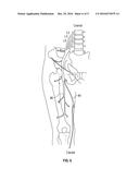 INTRAOPERATIVE MAGNETOMETRY MONITORING SYSTEM diagram and image