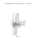 HEARING PROTECTION DEVICE WITH INTEGRATED AUDIOMETRIC TESTING diagram and image