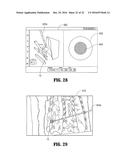 Planning System and Navigation System for an Ablation Procedure diagram and image