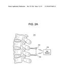 METHODS AND DEVICES FOR SPINAL CORRECTION diagram and image