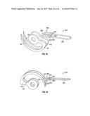 Medical Fastening Device diagram and image