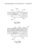 SURGICAL STAPLER WITH ANVIL SEATING DETECTION diagram and image