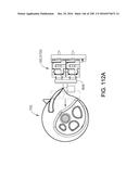 METHOD OF APPLYING AN ANNULAR ARRAY OF STAPLES TO TISSUE diagram and image