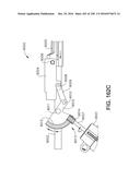 METHOD OF APPLYING AN ANNULAR ARRAY OF STAPLES TO TISSUE diagram and image