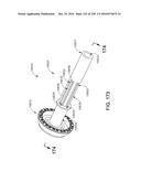 METHOD OF APPLYING AN ANNULAR ARRAY OF STAPLES TO TISSUE diagram and image