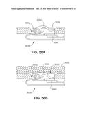 METHOD OF APPLYING AN ANNULAR ARRAY OF STAPLES TO TISSUE diagram and image