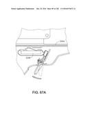 METHOD OF APPLYING AN ANNULAR ARRAY OF STAPLES TO TISSUE diagram and image