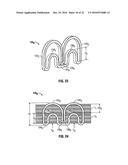 Variable Compression Surgical Fastener Cartridge diagram and image