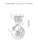 SURGICAL STAPLER WITH READY STATE INDICATOR diagram and image