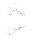 INCISIONLESS GASTRIC BYPASS METHOD & DEVICES diagram and image